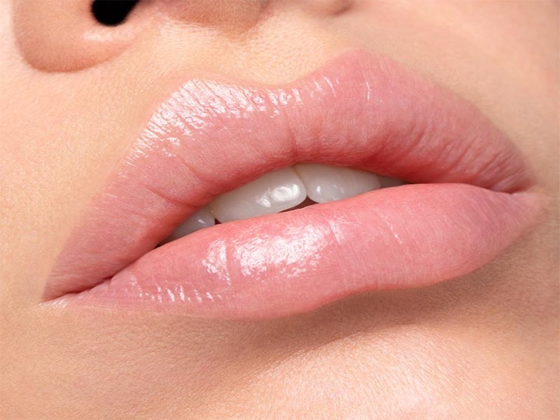 Imagen Mesoterapia Virtual